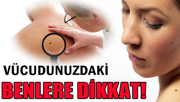 VÜCUDUNUZDAKİ BENLERE DİKKAT!