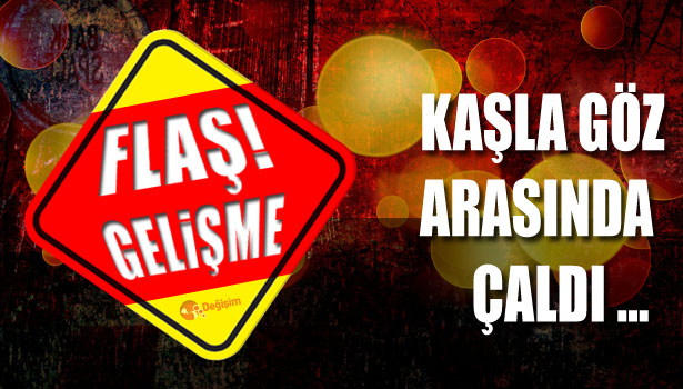 KAŞLA GÖZ ARASINDA ÇALDI