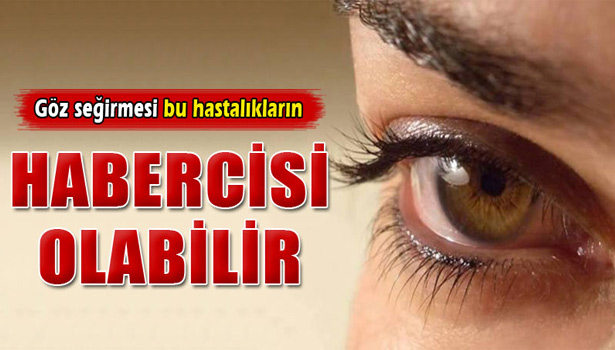 GÖZ SEĞİRMESİ BU HASTALIKLARIN HABERCİSİ OLABİLİR