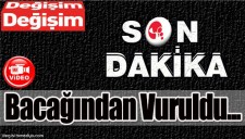 KOLA ALMAYA GİDERKEN BACAĞINDAN VURULDU...