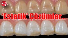 Diş Hekimliği Uygulama ve Araştırma Merkezinde Estetik Çözümler...