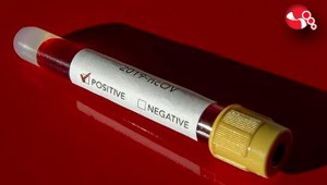 Zonguldaka yeni yasaklar...Düğünler, Kır Düğünleri...