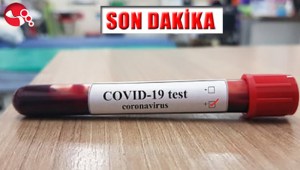 Genel Müdür İstanbula sevk edildi...