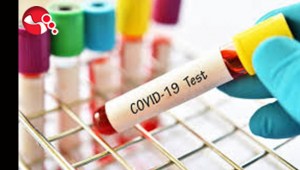 Vaka sayılarında NERELERDE DÜŞÜŞ NERELERDE ARTIŞLAR VAR