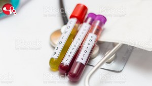 Koronavirüste son rakamlar…