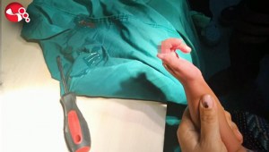 Parmağı korkuluğa sıkıştı