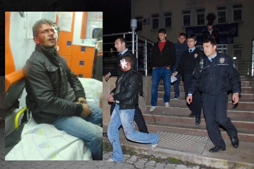 POLİS ARACINA KAFA ATTI CAMLARI KIRDI...